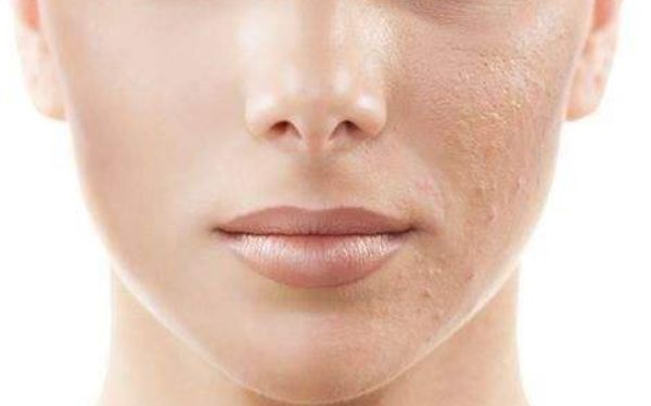 上海柴云做雙眼皮修復(fù)是否靠譜？體驗(yàn)如何？