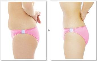 您在武漢協(xié)和醫(yī)院可以找到熱瑪吉嗎？預(yù)約技術(shù)嫻熟的醫(yī)生，口碑非常好！