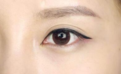 上海九院美容科的專家揭秘！魏皎、張余光、韋敏醫(yī)生值得信賴嗎？附磨顴骨體驗分享