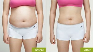 合肥祛眼袋，如何選擇最適合的醫(yī)院？