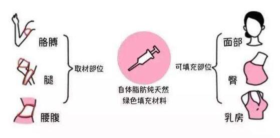 成都潘紅偉吸脂手術(shù)效果如何？專家解讀！