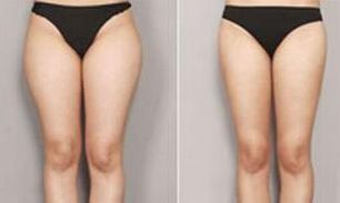 合肥祛痘效果最好的醫(yī)療美容機構(gòu)有哪些？