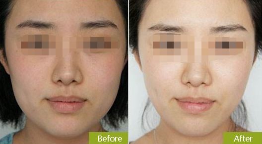 蘇州哪家整形外科醫(yī)院好？快速了解蘇州市頂級(jí)整形外科醫(yī)院推薦