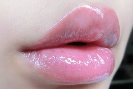 西寧哪家醫(yī)院的雙眼皮效果好？