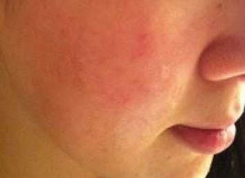 揭秘鄭州五位頗具盛名的鼻子專(zhuān)家，治療技術(shù)獨(dú)具匠心，深受人們推崇！