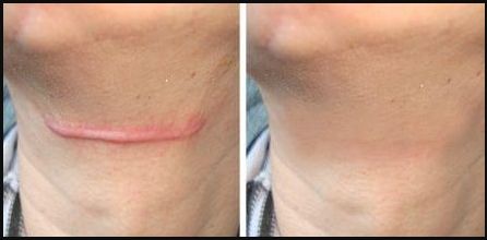 南京哪家私密醫(yī)院做得最好？來一探究竟！