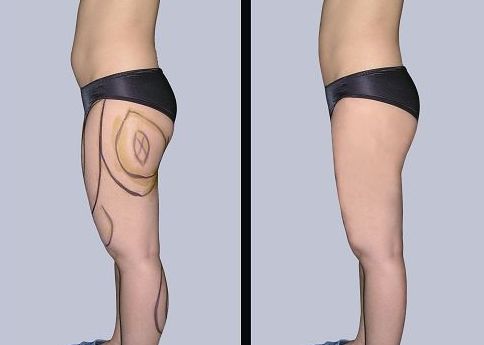 合肥哪家醫(yī)院可以有效治療腋臭問(wèn)題？