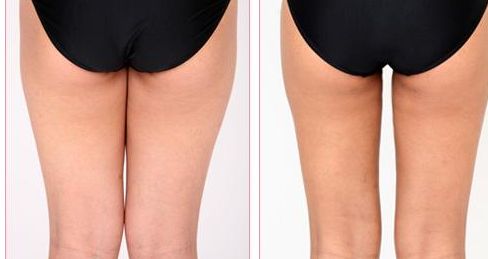 桂林私立醫(yī)院推薦，哪家好？2023最新排名解析