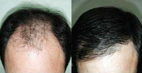 大連去狐臭哪家醫(yī)院效果好，專家推薦的醫(yī)院有哪些？