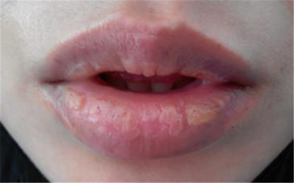 2023成都抗衰除皺正規(guī)醫(yī)生評(píng)價(jià)前10名(萬(wàn)端能、金可、趙敬國(guó)技術(shù)強(qiáng)口碑UP)