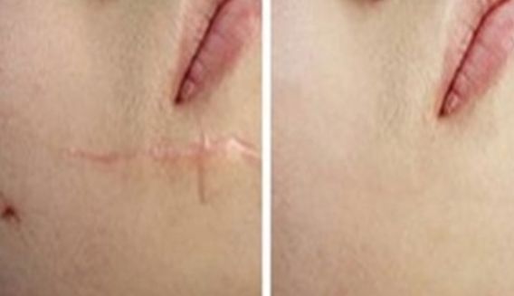 上海有哪些整形醫(yī)院值得推薦呢？