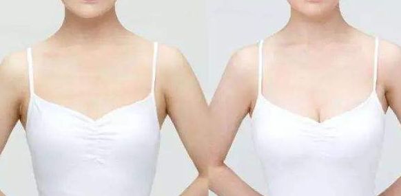 威海假體豐胸醫(yī)院哪家好？從專家口碑、手術(shù)效果看威海頂級醫(yī)院推薦！