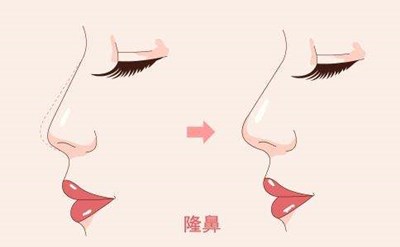 2023重慶膠原蛋白填充面部強(qiáng)榜前10名的專家(陳鵬、楊藝、蔣思軍這幾家技術(shù)高超價格低)