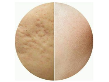 臺(tái)州薇閣醫(yī)療美容效果好嗎？李坤醫(yī)生簡(jiǎn)介、評(píng)價(jià)、位置一探究竟