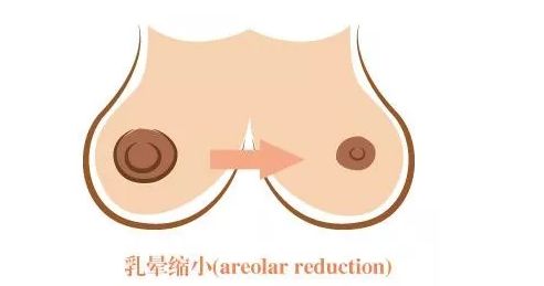 長沙激光美容醫(yī)院哪家好？探尋長沙地區(qū)激光美容行業(yè)領(lǐng)軍者