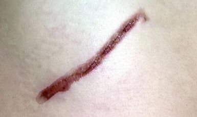 云南青少年減肥哪家好？探索云南地區(qū)青少年瘦身好方法