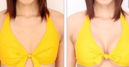 李健寧顱面裂畸形修復(fù)效果如何？想了解的人快來看！