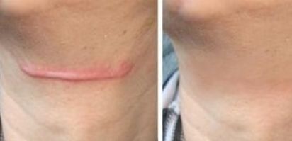 上海哪家醫(yī)院治療皮膚色素斑好？