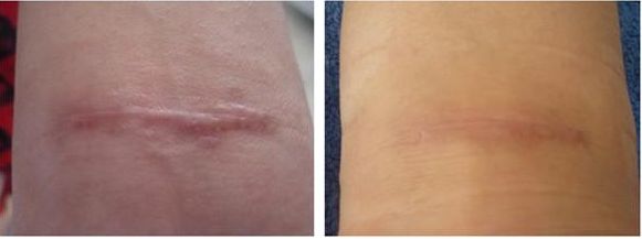 大連哪家眼科醫(yī)院提供修復(fù)外眼角最好的服務(wù)？