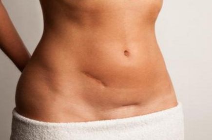 常州哪家醫(yī)院的激光祛痘療效好？