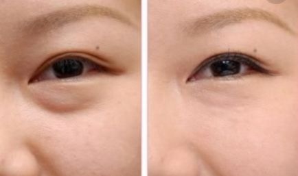 上海皮膚好的醫(yī)院有哪些？