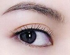 【2023年北京做鼻尖哪家醫(yī)院好？專家推薦解析】