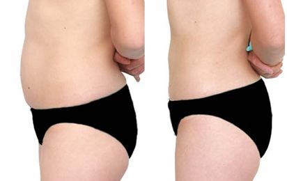 武漢哪家整形醫(yī)院的凸嘴技術(shù)好，值得信賴？