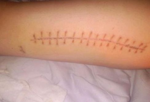 南寧?kù)畛毯勰募裔t(yī)院比較專業(yè)？