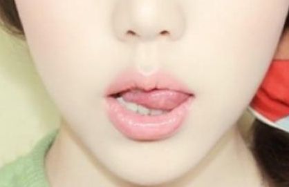 北京吸脂專業(yè)醫(yī)院排行榜發(fā)布：哪家醫(yī)院是北京吸脂正規(guī)專家？