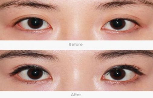 柳州哪家醫(yī)院做疤痕切除好？-獨家分享柳州疤痕切除醫(yī)院排行榜