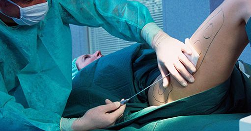 廣州美容整形醫(yī)院哪家好？推薦2023年評選的廣州頂尖美容整形醫(yī)院