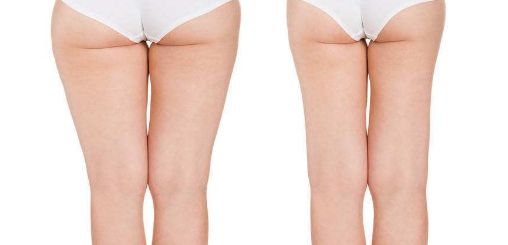 2023年西寧最受推薦的醫(yī)院紅血絲治療服務(wù)是哪家？