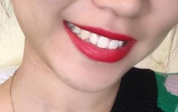 2023青島面部填充醫(yī)生前10(常書樓、白華寶、尹孝憲細(xì)數(shù)各家口碑)