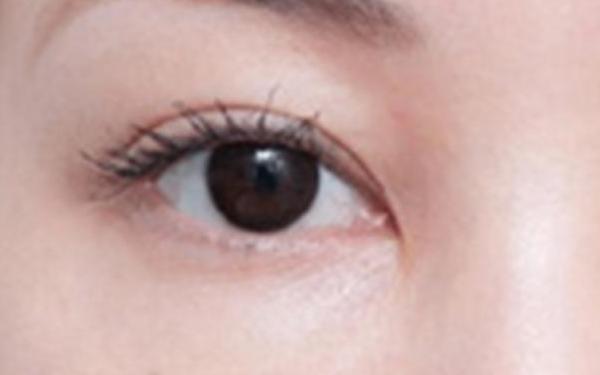 廣州哪家醫(yī)院做隆胸手術(shù)技術(shù)高？醫(yī)生資深經(jīng)驗(yàn)來看詳細(xì)介紹！