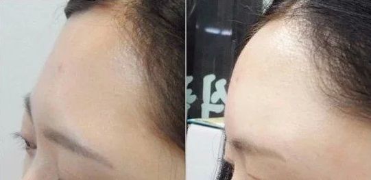 沈陽私密整形去哪家好？專家推薦排行榜2023