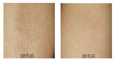 2023滕州點陣祛印第安紋專家排名top10強(qiáng)(羅斌、秦令揚(yáng)、王文科一起來看看吧)