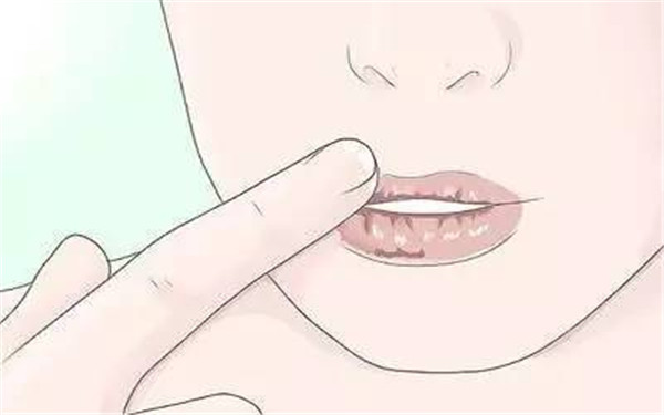 2023湖北動態(tài)細(xì)紋射頻去除醫(yī)生口碑TOP10(周閻施婧、高瑋、雷新明技術(shù)優(yōu)勢介紹)