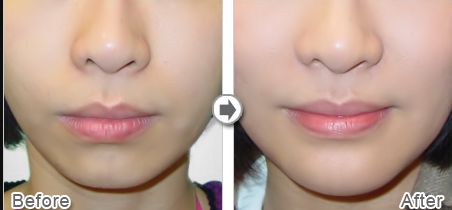 上海做雙眼皮哪家好醫(yī)院？專家評選2023年最佳雙眼皮醫(yī)院