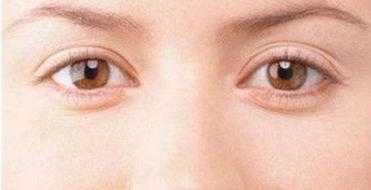 上海九院鼻部整形效果如何？聽聽用戶的評價