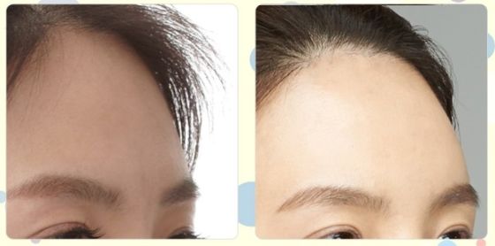 南京最好的祛痘醫(yī)院是哪家？揭秘南京治療痘痘首選醫(yī)院