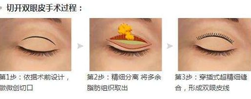 淮安光子嫩膚醫(yī)院哪家好？專家為您推薦5家權威醫(yī)院