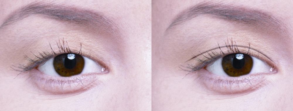 深圳鼻綜合整形哪家醫(yī)院好？完善整形美容的深圳專家醫(yī)院推薦