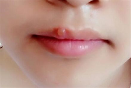 2023舟山面部溶脂針醫(yī)生前十位榜單(別小敏、倪彬、周其光權(quán)威機(jī)構(gòu)專家盤點(diǎn))