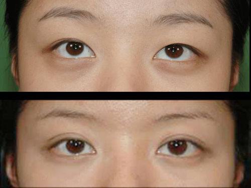 2023武漢冷凍法酒糟鼻治療top10的醫(yī)生(陳佳旭、馬超群、王介聰從實(shí)力看不輸公辦)