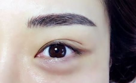 銀川有哪些專業(yè)的激光祛痘印醫(yī)院值得推薦？