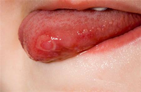 2023信陽(yáng)精雕瘦腰部專家排行前十位(正冬學(xué)、李孝輝、周平價(jià)格實(shí)惠公道)