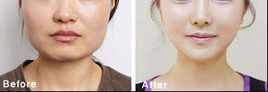 南昌熱瑪吉哪家醫(yī)院做得好？專業(yè)推薦南昌市xx醫(yī)院