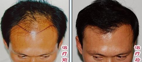 榆林醫(yī)專附屬醫(yī)院醫(yī)學(xué)整形美容中心怎么樣？榆林醫(yī)專附屬醫(yī)院醫(yī)學(xué)整形美容中心簡介|醫(yī)生團隊|口碑評價！