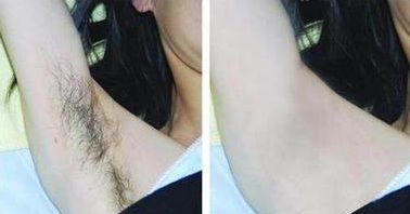 成都整下巴哪家醫(yī)院好，專家助你實現(xiàn)完美下巴線條