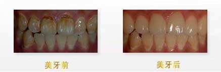 揭秘：武漢眼科醫(yī)生，他們的技術無人能敵！